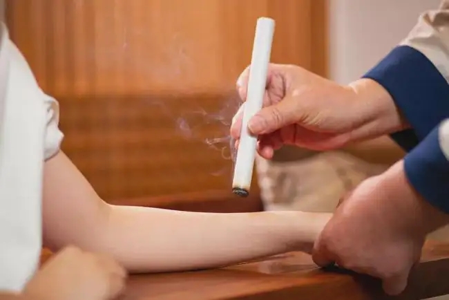 艾灸和拔罐的注意事項！